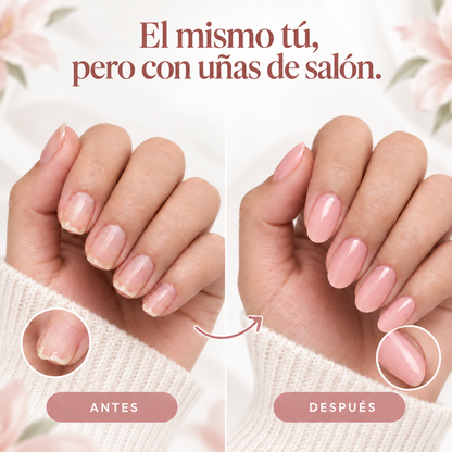 Lunexor Gel-Set™